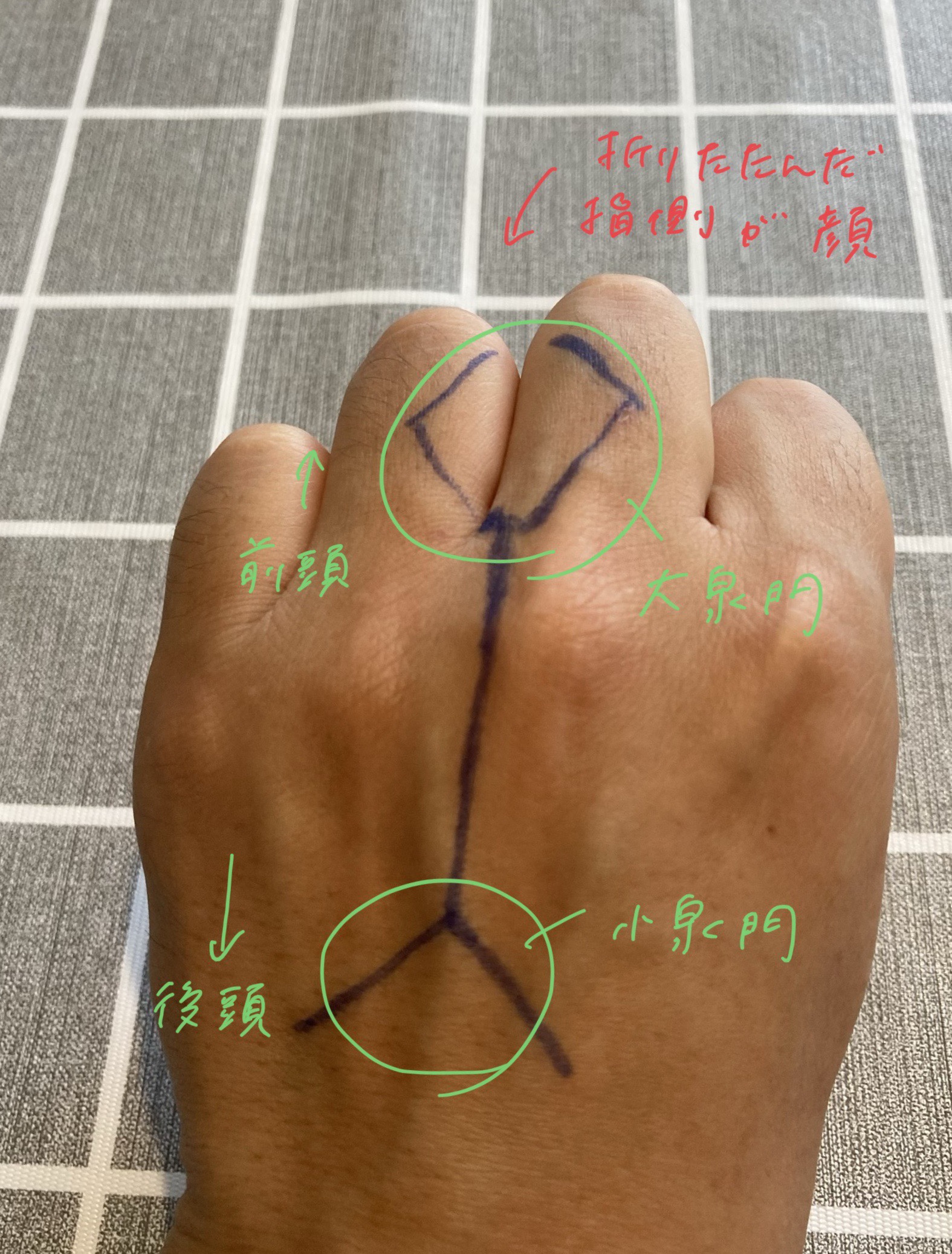 回旋正常 – 回旋異常 体位変換 _ 胎児の回旋 – IAMOA
